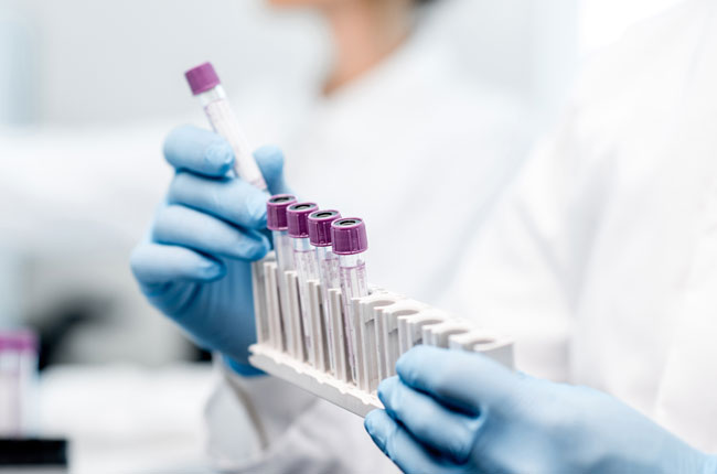 Employee health screening